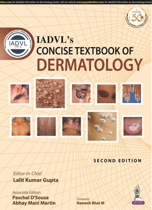 IADVL Concise Textbook Of Dermatology