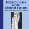 Tuberculosis Of The Skeletal System S M Tuli