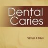 Dental Caries by Vimal K Sikri
