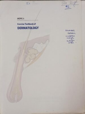 Second Hand Concise Textbook of Dermatology By Vishalakshi Vishwanath 2012