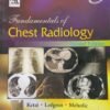 Second Hand Fundamentals of Chest Radiology 2nd Edition By Ketai 