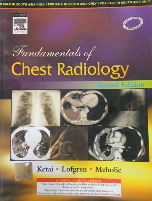 Second Hand Fundamentals of Chest Radiology 2nd Edition By Ketai 