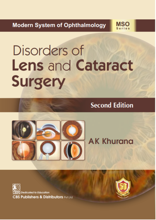 Disorders of Lens and Cataract Surgery By AK Khurana CBS Publication 2023 